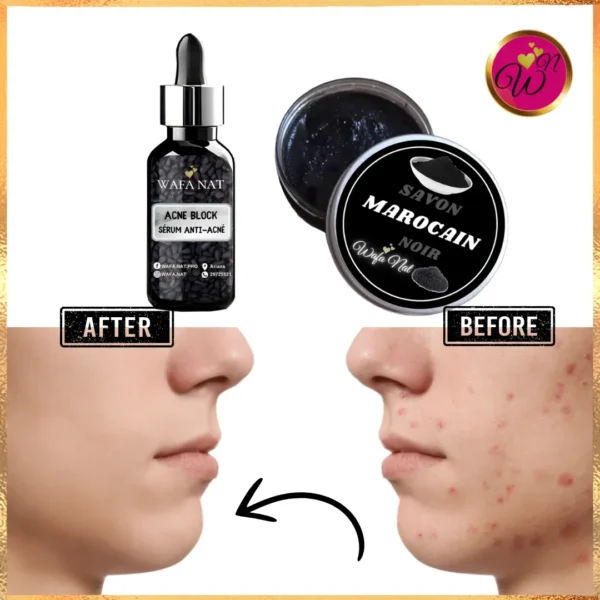 Pack Anti-Acné Wafa Nat – Pour une Peau Nette