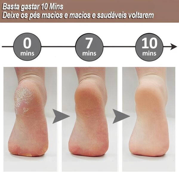 Flawless Pedi Electronic Electronic Pedicure